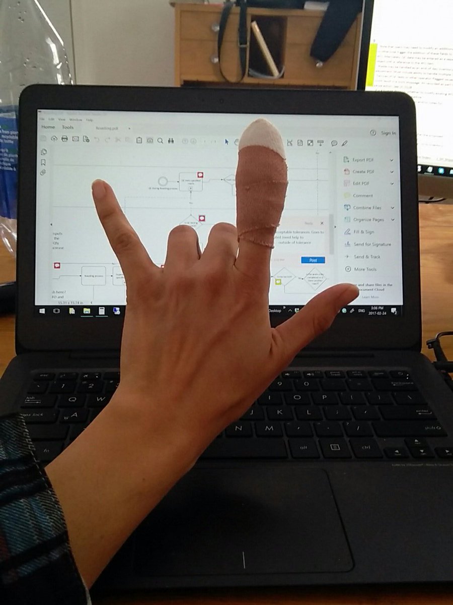 pivot_data's tweet image. When your ET finger makes typing challenging.....