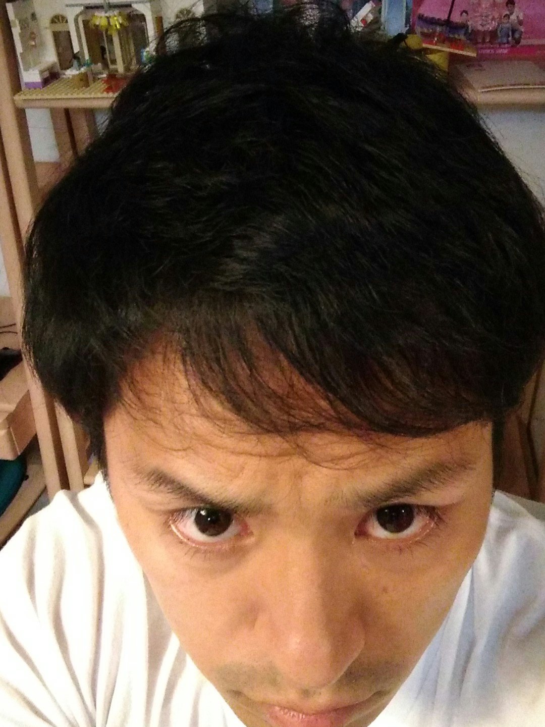 はげてきた Twitter Search Twitter
