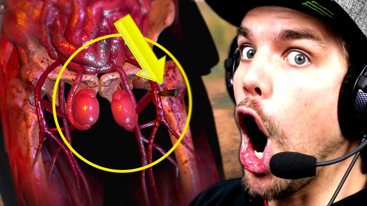 FRSkyRRoZ's tweet image. TIR DANS LES TESTICULES !!
youtube.com/watch?v=eSVueG…