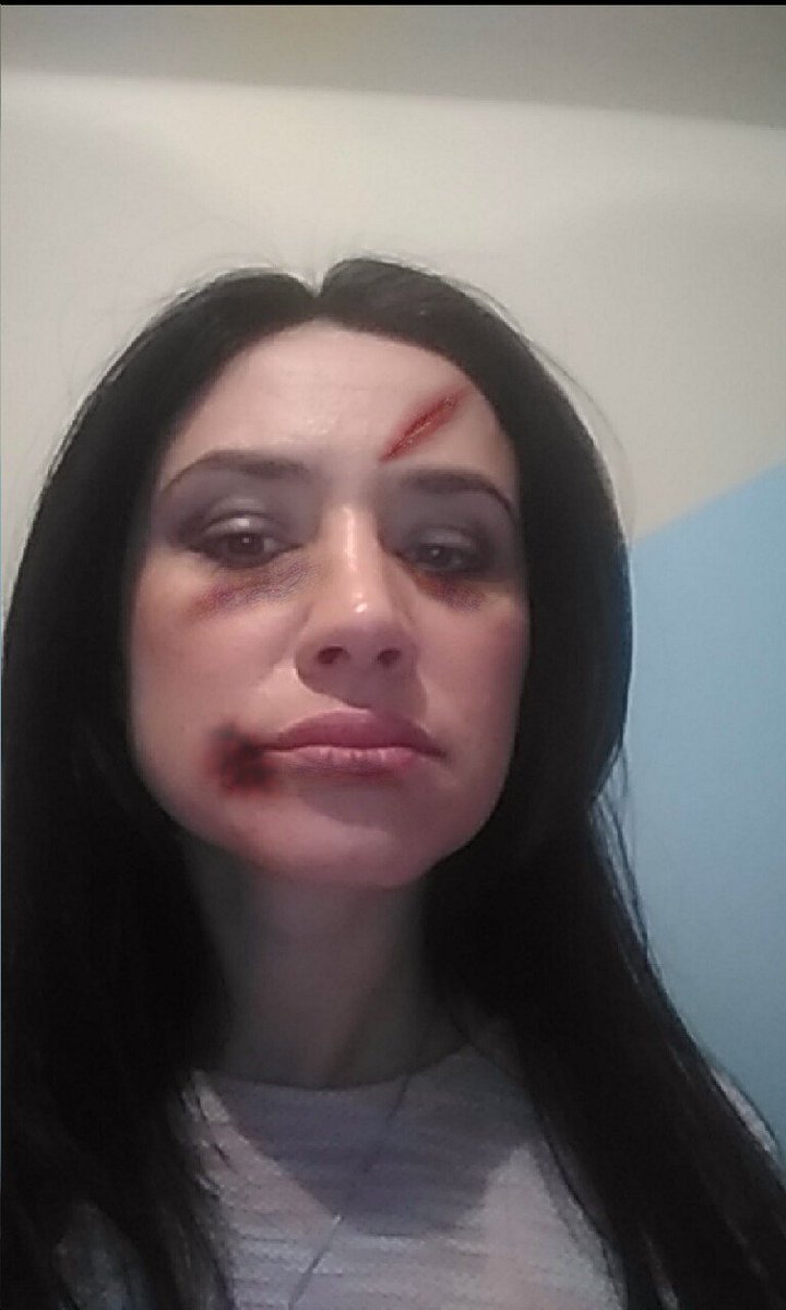 SelfikonApp's tweet photo. "Savetovalište protiv nasilja u porodici (Sigurna kuća) daje punu podršku ovoj akciji. #stopnasilju
https://t.co/Se9XsN5lW0 https://t.co/qYukNvDyWo