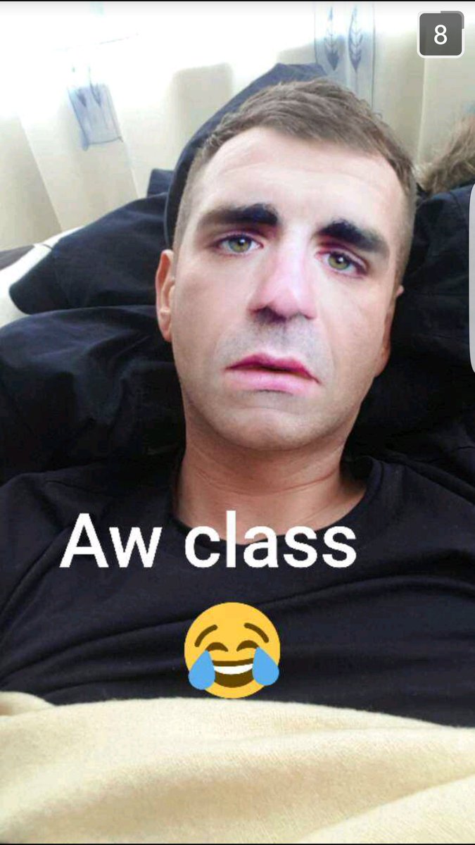 JohnnyHihats's tweet photo. @brilliantshane im a big fan of yours. I think you are the best comedian in Ireland #awclass #mitsubishihatchbacksnoflashbacks https://t.co/cEbOQfc1CQ
