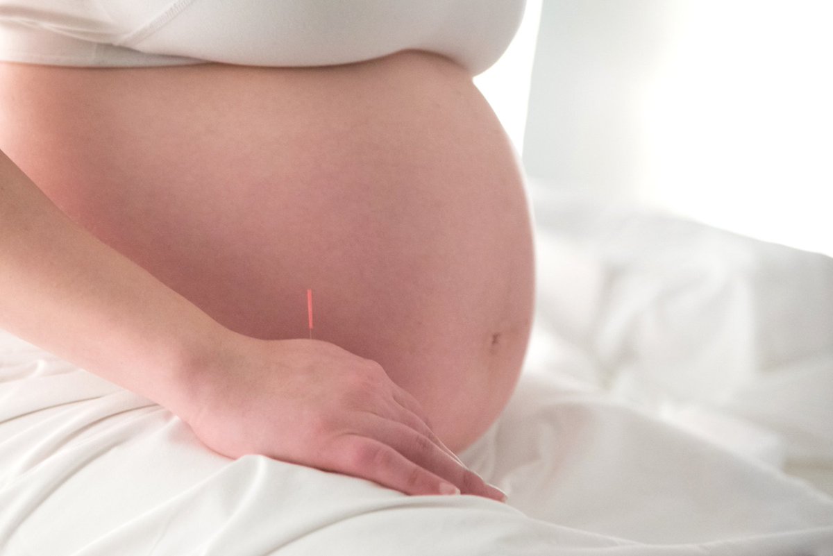 acurate_site's tweet photo. Forbidden #acupuncture points during #pregnancy  It appears that there's more than one answer https://t.co/n1LLbex99k https://t.co/sNzfLB9TYT