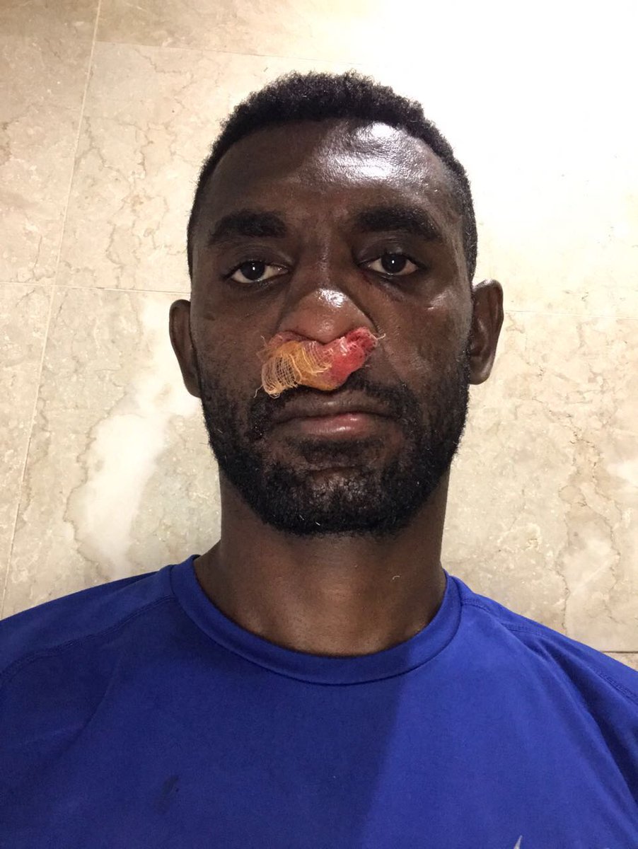 Hidung patah dan bibir pecah tak masalah, masih fight 90 menit. Maaf untuk suporter belum bisa bawa kemenangan.