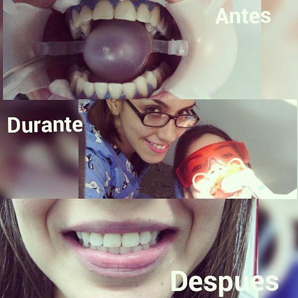 CISonrisas's tweet photo. BLANQUEAMIENTO realizado por la Dra Andreina Campos. En una sesión y sin dolor! Reserva tu cita 0251-2530736 https://t.co/08P7oAP2Fh