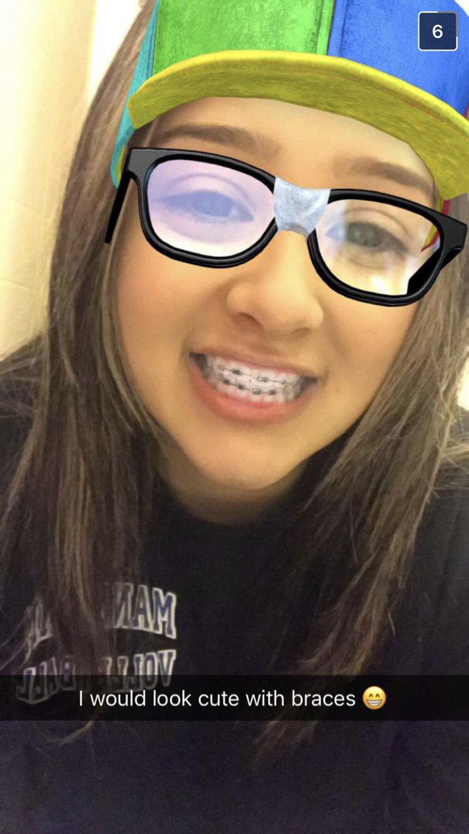 lostboycray's tweet photo. Looking gorgeous in braces 😍❤️❤️lol #gotchaa https://t.co/l4DRYdMIPz