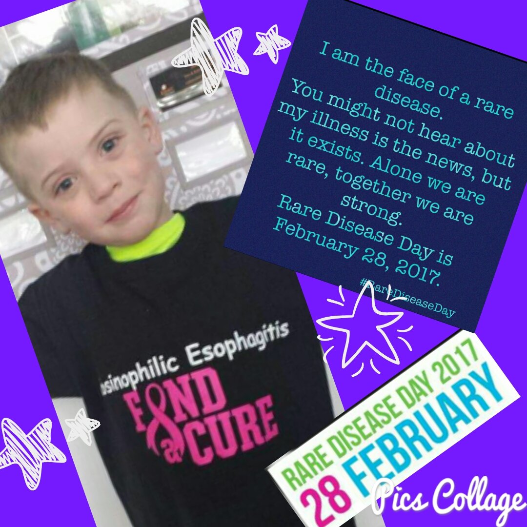 monkey629's tweet image. #RareDiseaseDay  Brody age 6
Our hero!!!