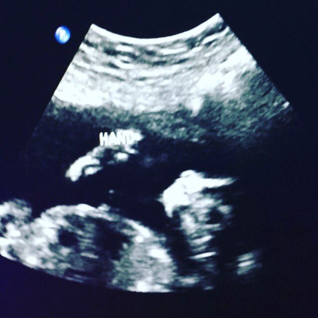 olsonamber16 tweet picture