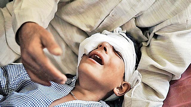 Jammu and Kashmir: To save eyes, pellet guns get deflectors dnai.in/dYMq https://t.co/bTuUg8VUsd