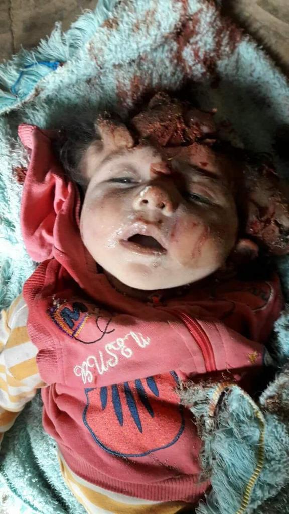 MOHJOM11's tweet photo. #why
#SYRIAN_CHILDREN
#WhiteHelmets
#Assad_regime_WarCriminal
#Obama_silence_Crimes
#Humanity_fail
#Shame_on_Humanity
@POTUS
@VP https://t.co/bolImfXeag