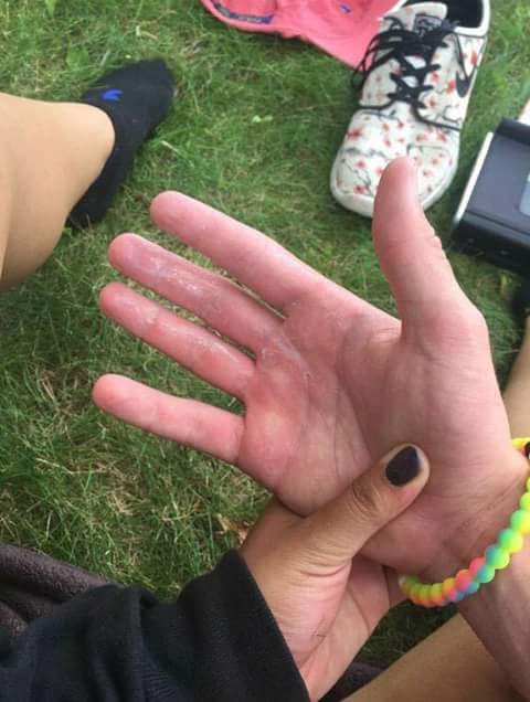 SilfridoSanchez's tweet photo. Picnic https://t.co/z8BFq74ZXm