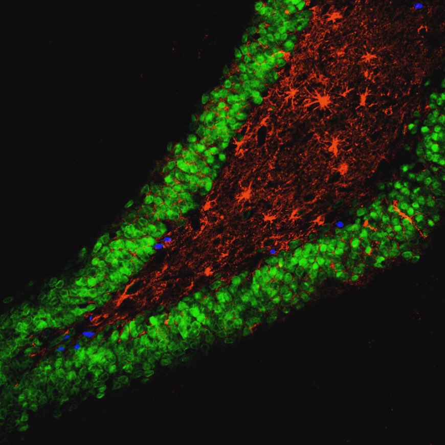 CIRMnews's tweet photo. Happy #BrainAwarenessWeek! Here's a rat hippocampus: brain #stemcells in blue, neurons in green, astrocytes in red. https://t.co/zmcujc3RuF https://t.co/VxqbBgP2o3