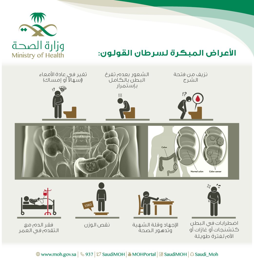 SaudiMOH's tweet photo. بادر بزيارة الطبيب في حال لاحظت أحد هذه الأعراض.
#سرطان_القولون https://t.co/nwmtYVnmod
