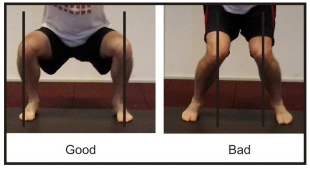 Why “Knees Out” might not be the Best Cue when Squatting.  

bit.ly/NotBestSquatCue