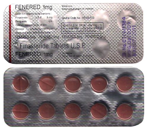 finasteride usp 1mg