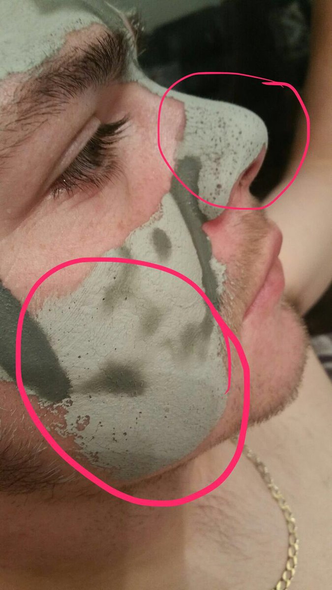 Rach__78's tweet photo. Get your skin spring ready with this magical Marine Mud Mask. You will visibly see the pores being drawn from your skin. https://t.co/Z1hYn8CC6k