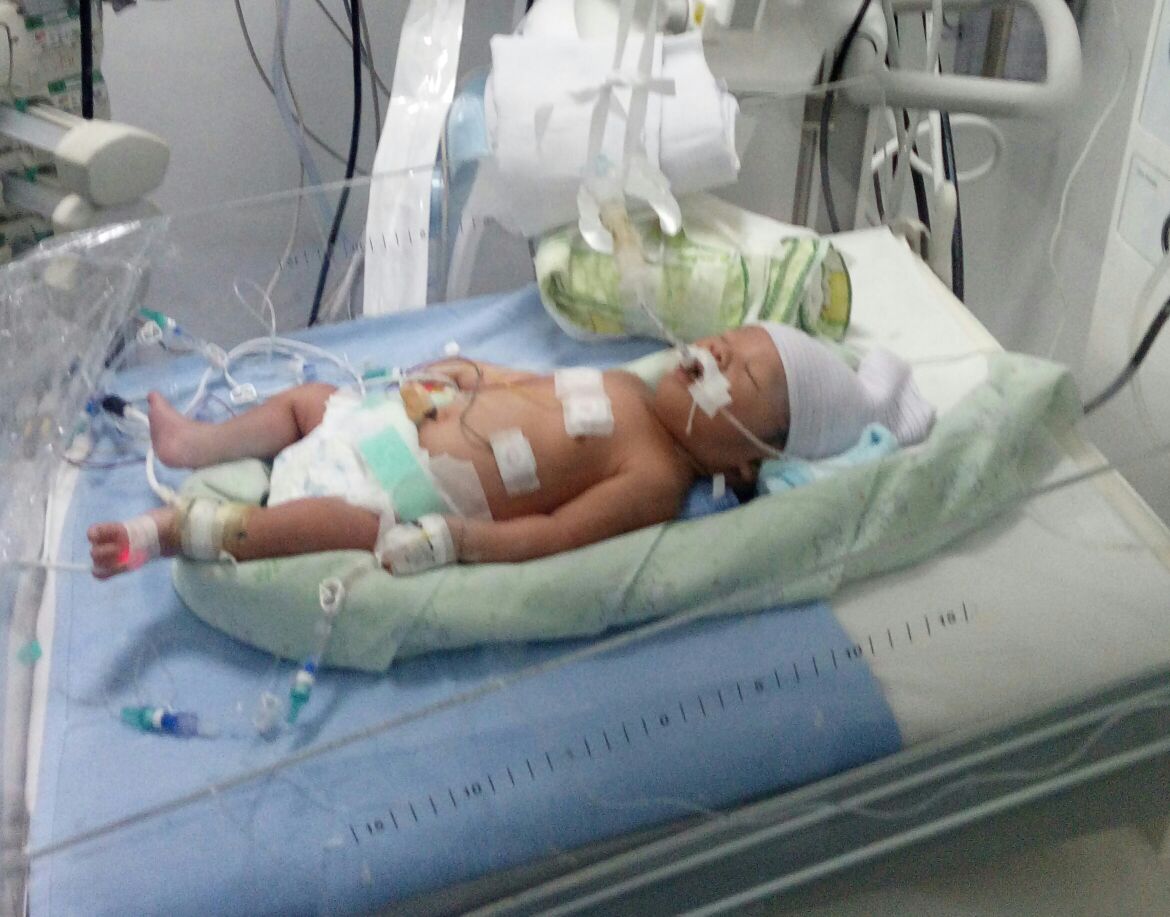 #needhelp #solidarity #baby #needhelp #repath 
Info lengkap bisa langsung hubungi Thomas - 08113978221