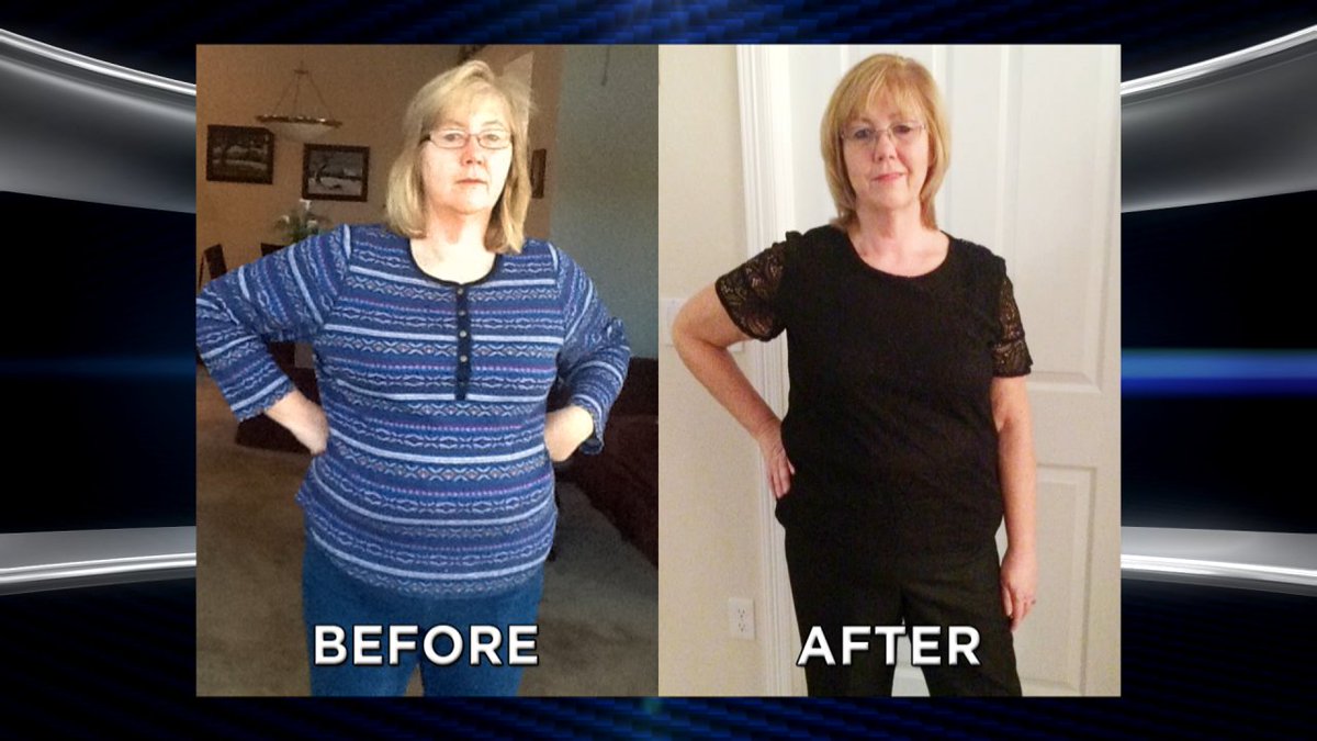 TheDoctors's tweet photo. Can a new surgical implant combat obesity by reprogramming how your stomach tells your brain it's hungry? https://t.co/aA2cK4kSNs https://t.co/JURzeH0jao
