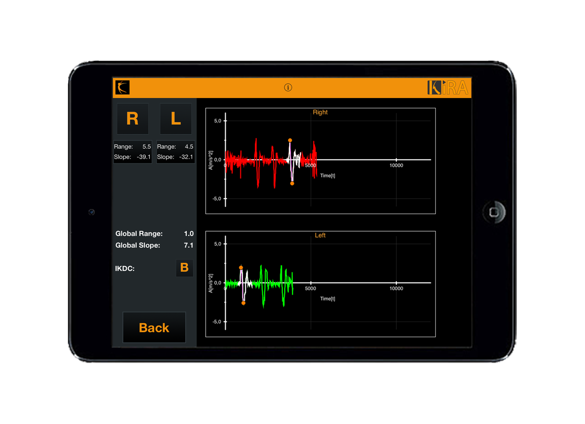 #KiRA supports the analysis of knee joint kinematics and dynamic laxities #aaos2017 - #booth440