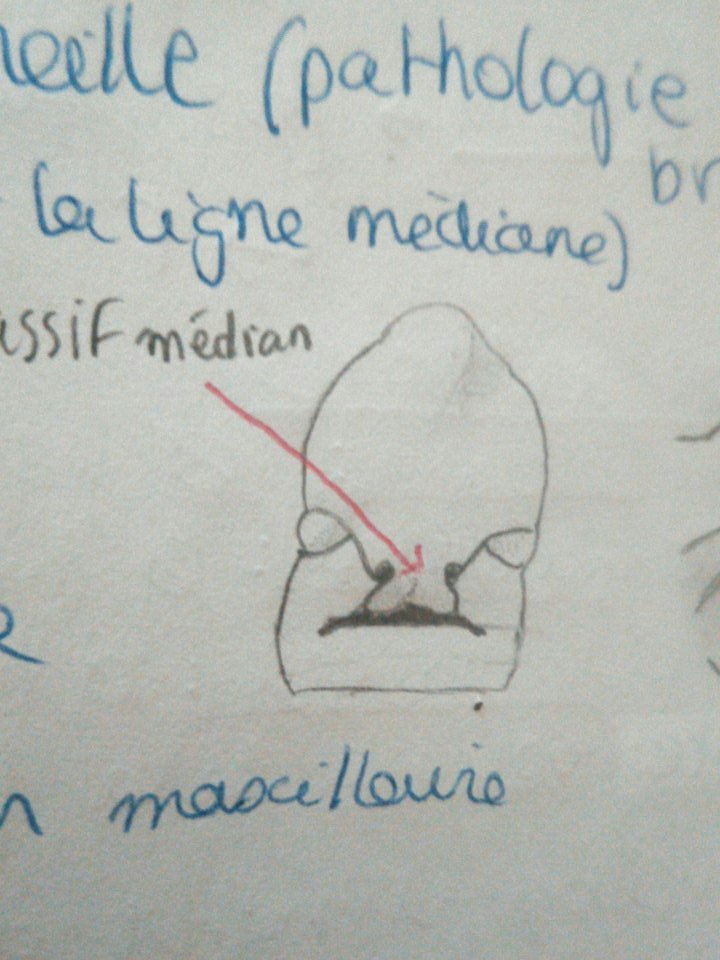 jaasphy's tweet photo. Chui morte l'embryon à 6 semaines on dirait l'amiral ackbar https://t.co/sFF34k4yrz
