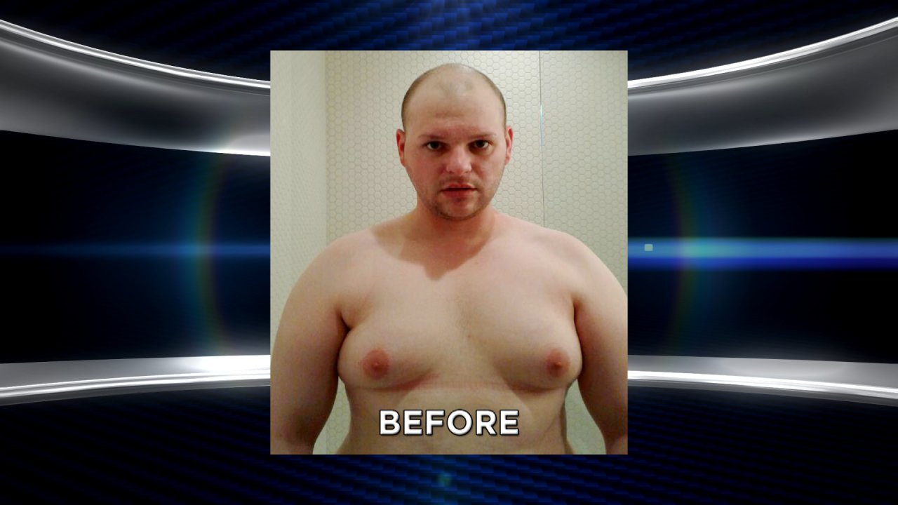 The Doctors on X: A young man bullied for his large breasts returns after  having surgery.   / X