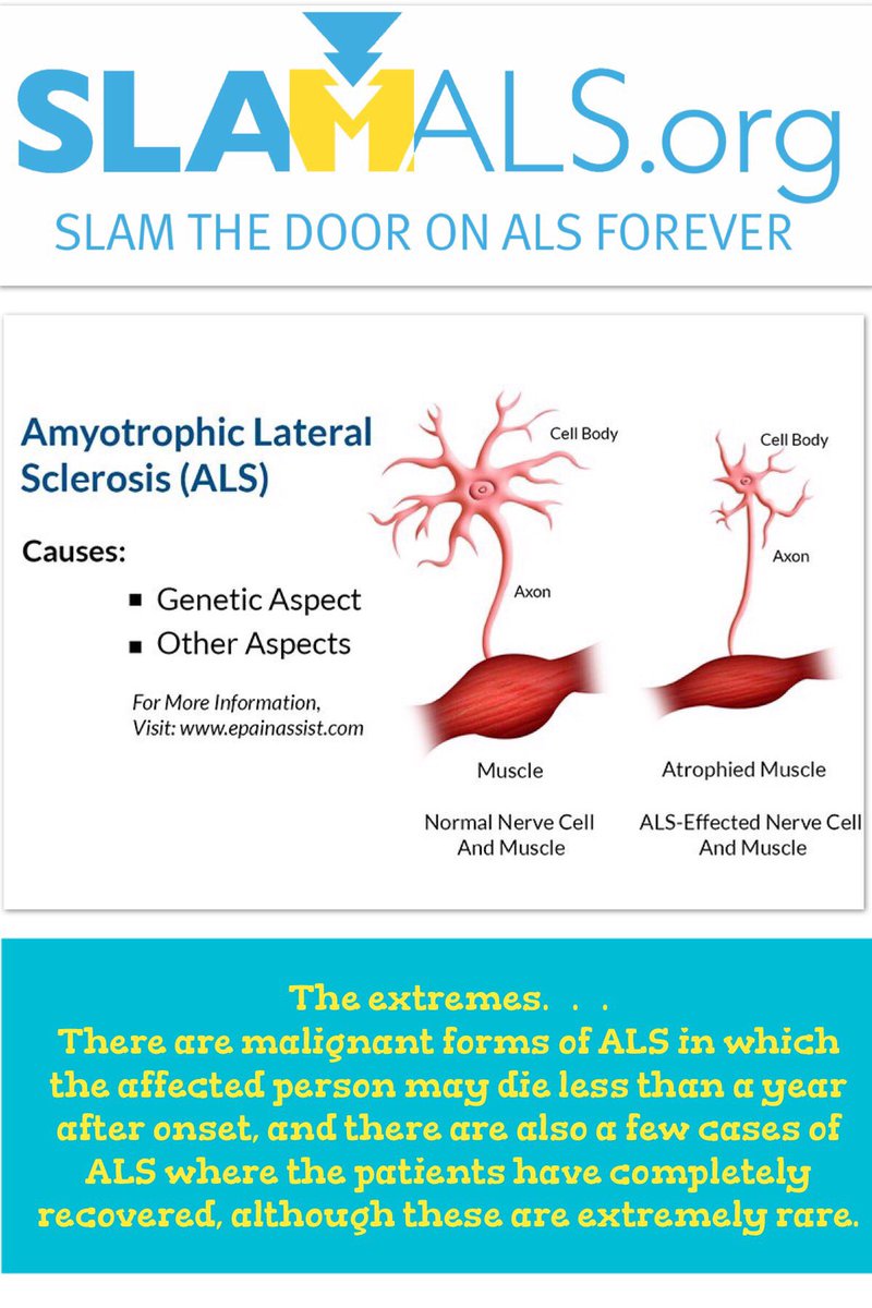 slamALSorg's tweet photo. The extremes…#slamALS https://t.co/qBQGawVhck
