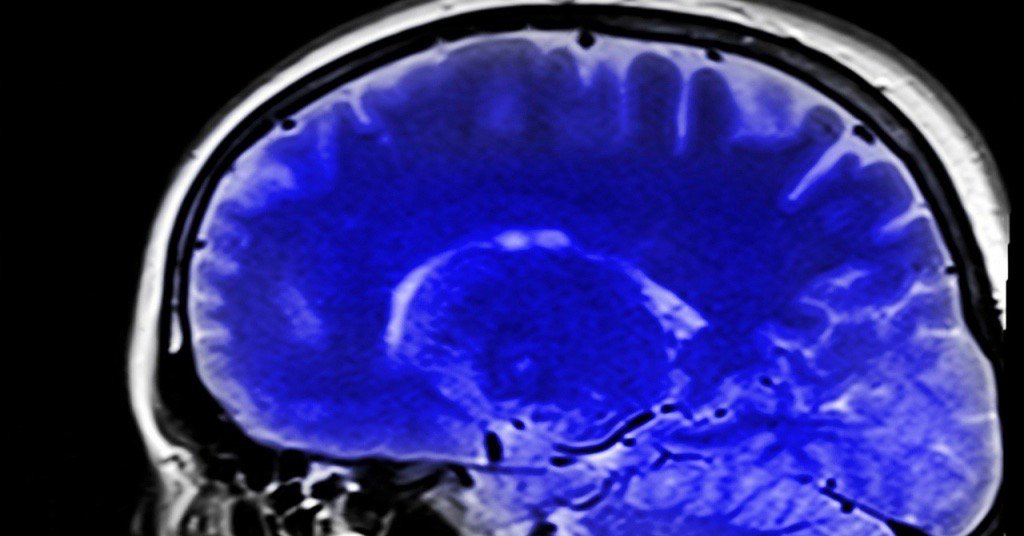 New brain research suggests difficulty with learning what is "safe" is involved in developing #OCD - ow.ly/2iuI309OTcD