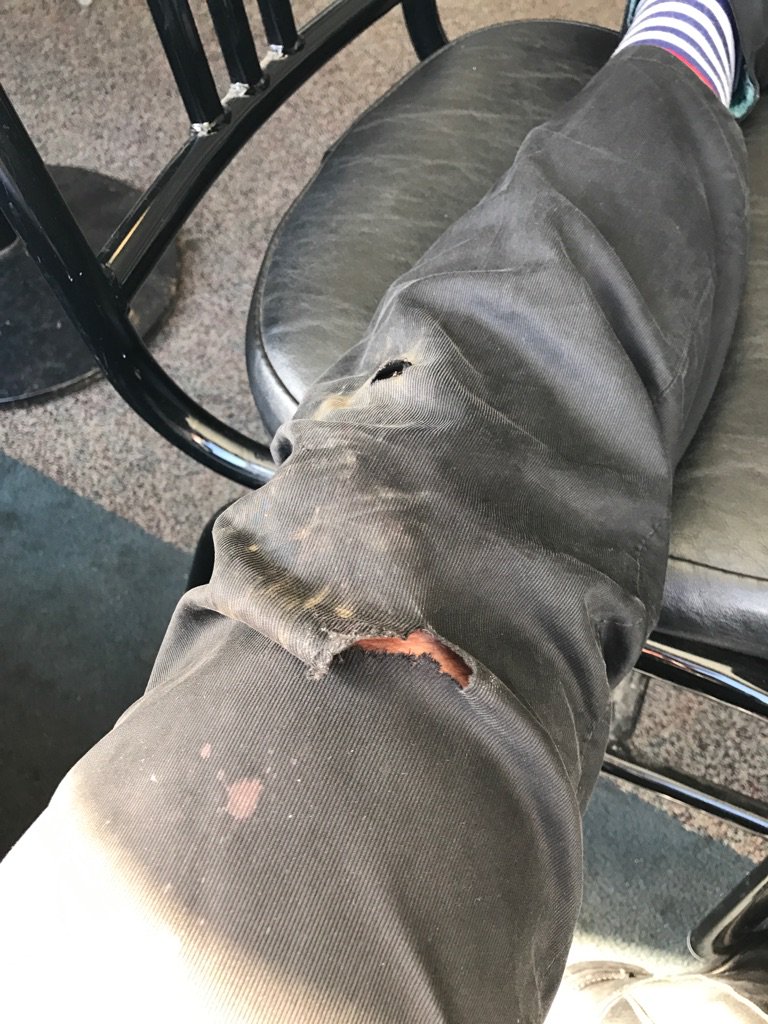Gary_Fisher's tweet photo. Crashed on market st today. On the ferry going home now. Tracks and speed. I will never learn. https://t.co/S0GLjBBvKy