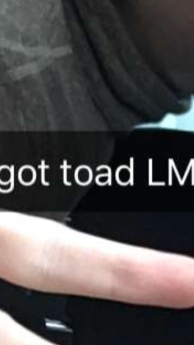 when you get towed and your friend tries to roast you 🐸 <a href="/brook_duh_bomb/">Brooklyn Smith</a>