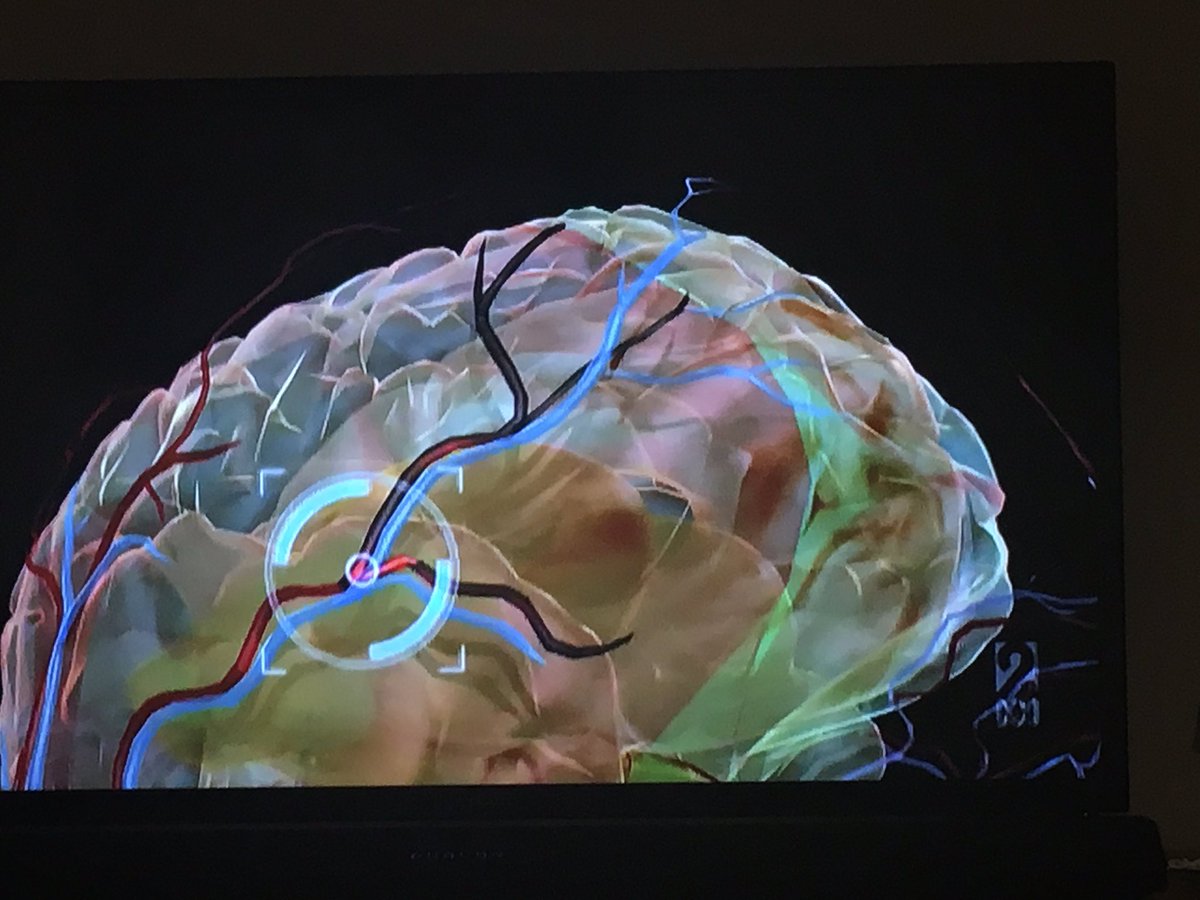 svwbs's tweet photo. A neurological scan reveals online harassment has the same effect on the brain as experiencing physical assault. #cyberhate https://t.co/nhvsdgNxOs