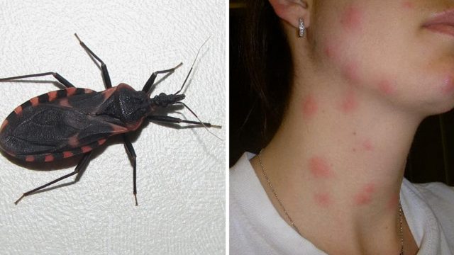 HomesteadNotes's tweet photo. If you are bitten by this bug you are in real danger - https://t.co/w3dN09OQiz https://t.co/1TvqUuAnEb