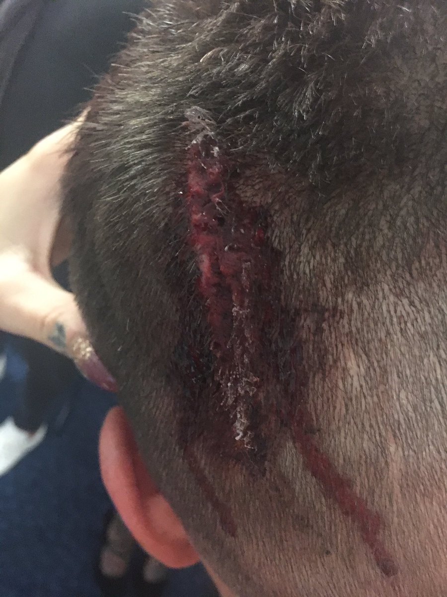 C_Ross22_'s tweet photo. "Wrestling is fake." #GetWellSoonJordan https://t.co/7QGu3n7u7C