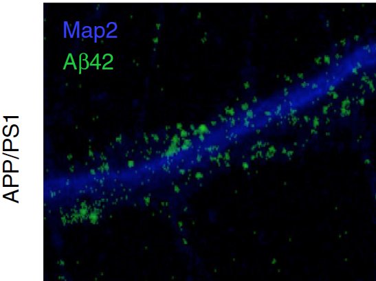 dheerajroy7's tweet photo. Pre-plaque changes in Alzheimer’s disease-linked Aβ and APP via @NatureComms https://t.co/fKL9zO8BMs #earlyAD https://t.co/7UTX50oDUJ