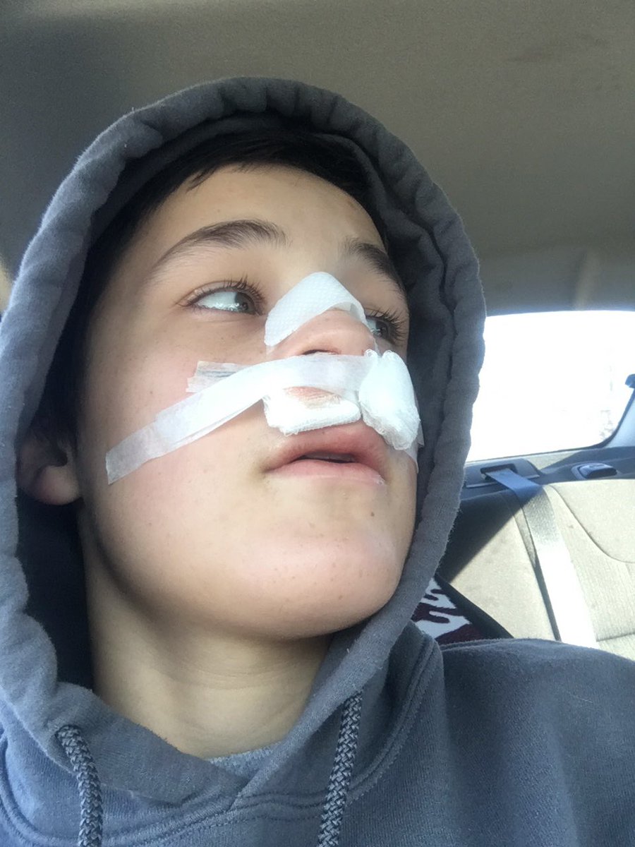 Allen parlier (ParlierAllen) Twitter