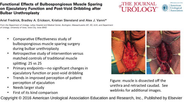 JUrology's tweet photo. First of its kind comparison of urethroplasty technique with functional outcomes: https://t.co/6pplOt0Vih https://t.co/QCoS1MWL9k