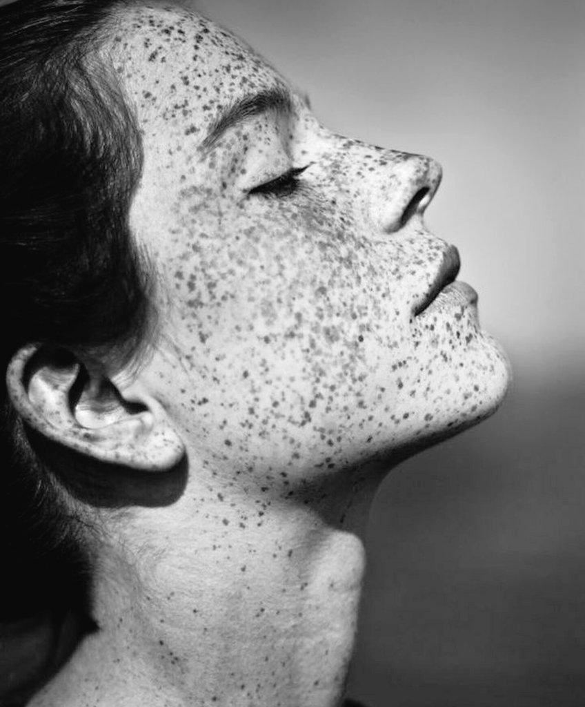 So many freckles 🙈