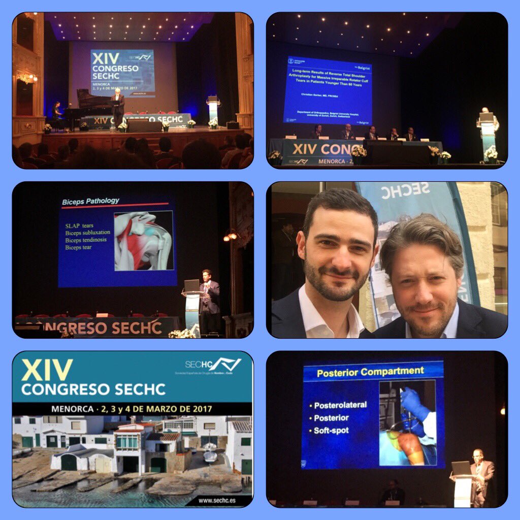 dr_ezagui's tweet photo. Congreso SECHC 2017 Menorca. #sechc #hombroycodo #shouldersurgery #elbowsurgery https://t.co/QUYBn9nnGC