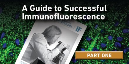 CellSignal's tweet photo. Successful #Immunofluorescence: The Importance of #Validation https://t.co/hRHRK6vwJG #labexpectations #cellsignalingtechnology https://t.co/DHUfXObCpH