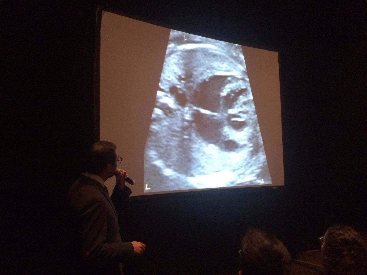 Pasantes_Cardio's tweet photo. Detección, diagnóstico, abordaje, manejo y asesoramiento. Aplicaciones de la cardiología fetal. Ponencia del Dr. Martínez #1aEstatutaria17 https://t.co/4HbcbWoPyG