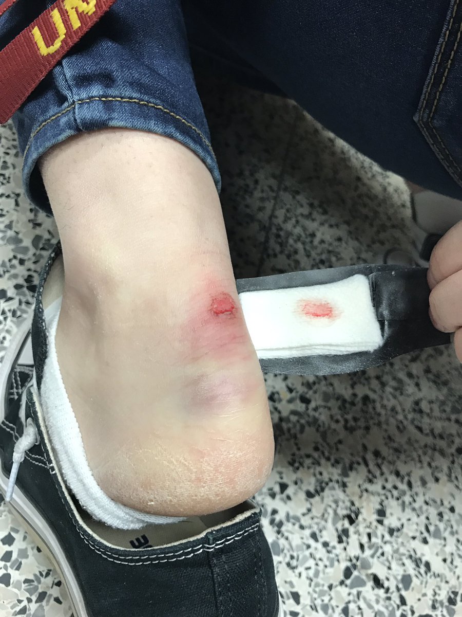 One of our team members got run over by a food cart at @DuluthDECC. Whoever pushed it didn't say sorry and just kept going. :( #OMGRobots