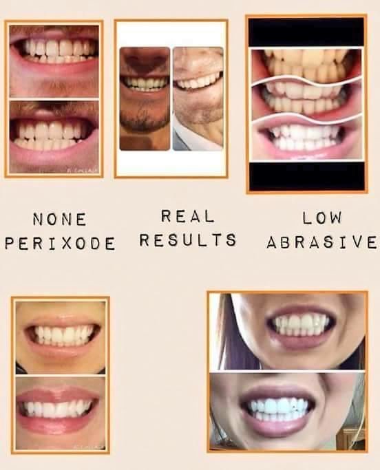 shellsecretsVIP's tweet image. Want #whiterteeth? #beautiful #smile? #proxidefree! #nonabrasive! #whiteningtoothpaste ✨
#wecanhelp #messageustoday #Brighton #Hove