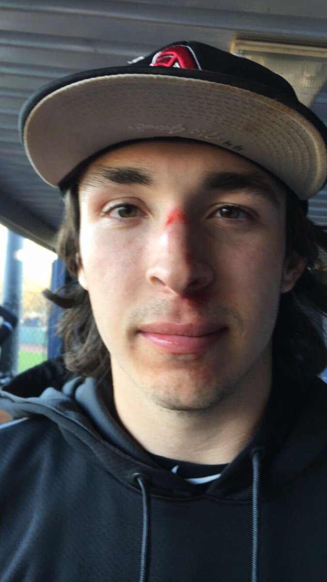 PoThings's tweet image. *falls over railing trying to get a foul ball*