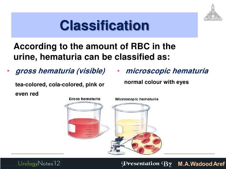 MLS_GH's tweet photo. ال ( #hematuria )وأسبابها الشائعة حسب الأعمار .[ #laboratory , #med_lab ]
[#مختبرات_طبية ، #طب_مختبرات ] https://t.co/tlT37QqsPi