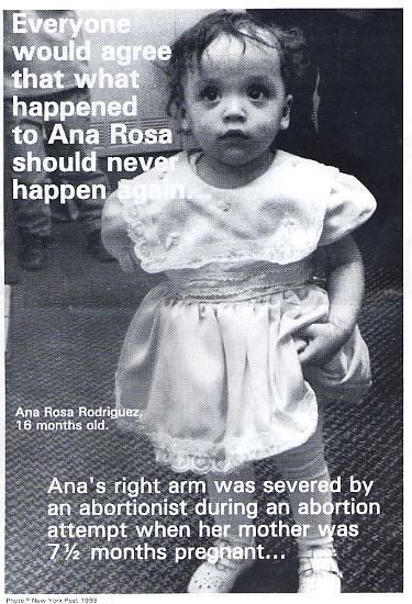 LifeNewsToo's tweet photo. Remembering When an Abortionist Severed the Arm of a Baby Who Survived a 32-Week Abortion https://t.co/GHEGMvpfDL https://t.co/e9Cr8umeC2