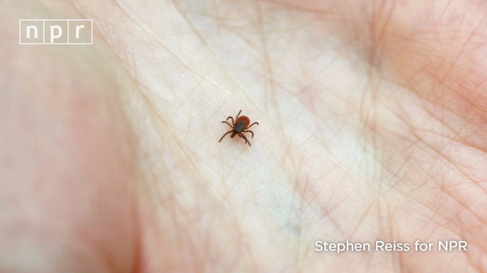With increased concern over Lyme this year, here's what to do if you get bit by a tick n.pr/2mLMBiT