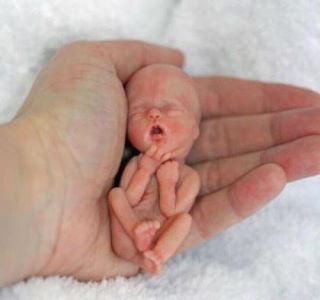 ThePOTUSMiranda's tweet photo. Does this not look human to you? Do their lives not matter ? #prolife https://t.co/FnfqXriSFW