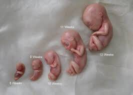 ThePOTUSMiranda's tweet photo. Does this not look human to you? Do their lives not matter ? #prolife https://t.co/FnfqXriSFW