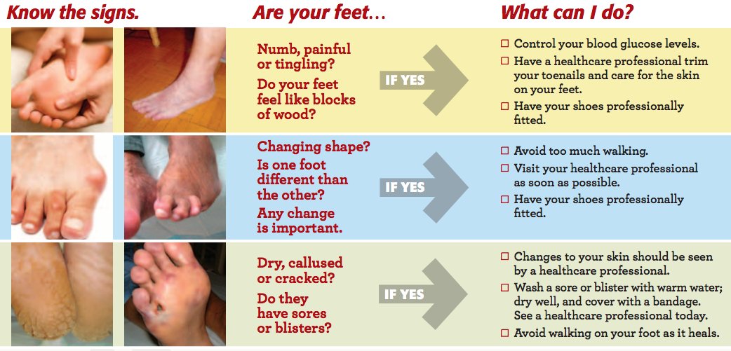 Diabetes Dry Feet