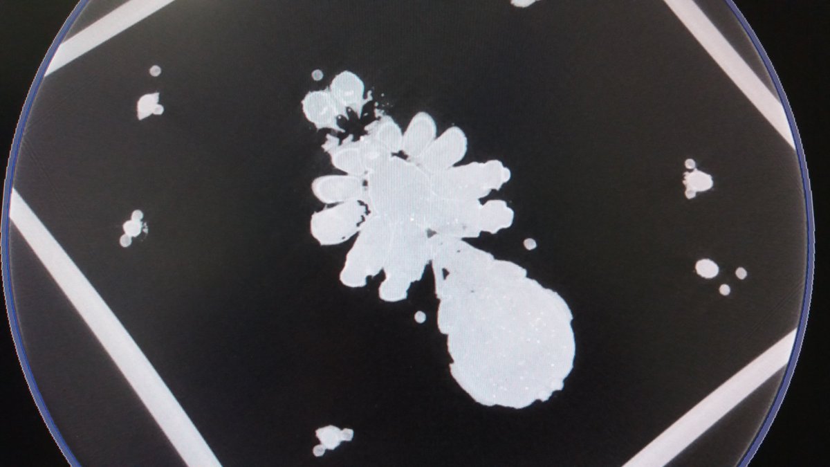 These are some of the scan images that are being 'stitched' together to form a 3D result. How cool is that?! <a href="/NHM/">New Hope Middle</a>-Arachnida <a href="/NHM/">New Hope Middle</a>-London