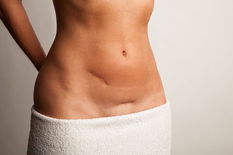 We have two treatments to help reduce stretch marks and scars. Check them out here... #Brighton #Beauty #Dermapen ow.ly/nU3z309sfqB