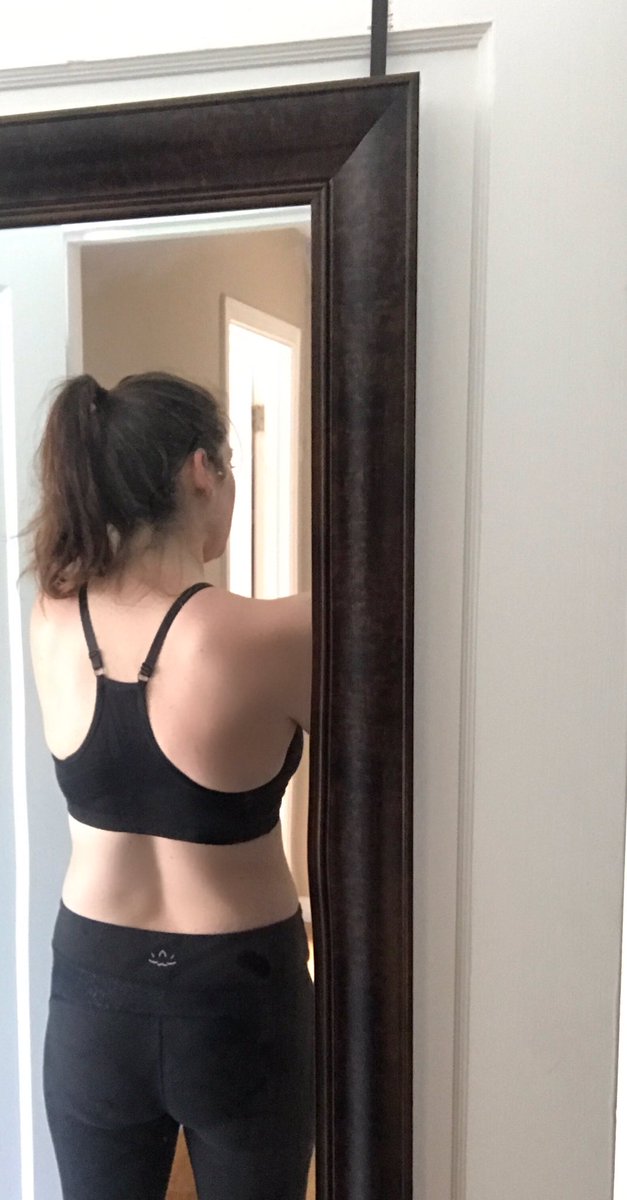 Mrs_Townsend_1's tweet photo. Here we go #Shred10 Getting back on track! 18lbs down, 15 to go! #onesimplechange #twoweekspostpartum #beforephotos #nursingmom https://t.co/tISZCRXIzQ